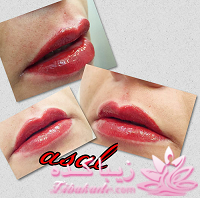 هاشور ابرو - میکروپیگمنتیشن - عسل